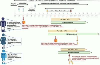 Aspirin use and bleeding events during thrombocytopenia after autologous stem-cell transplantation for multiple myeloma